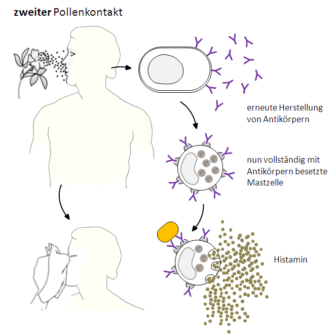 allergische Reaktion beim zweiten Pollenkontakt